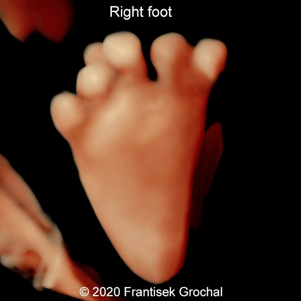 01 Right foot
