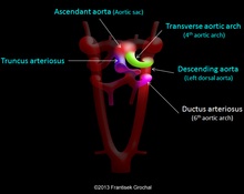Aortic arch anomalies image