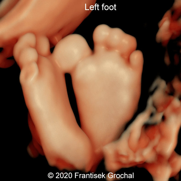 02 Left foot