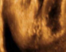 Female genitalia, 3D scans image