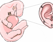Malformations of the external ear image