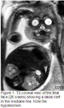 fig1
