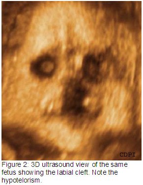 fig2