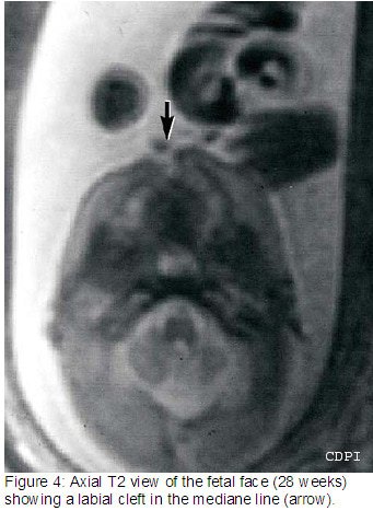 fig4