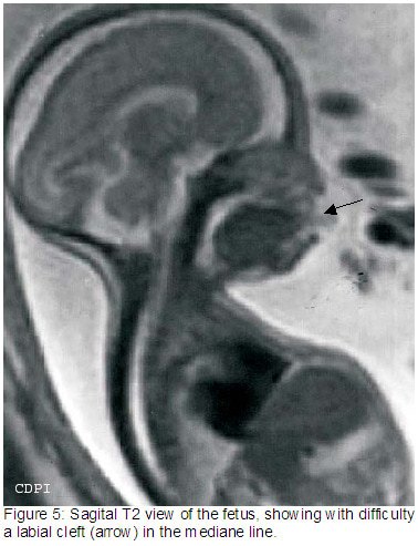 fig5