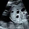 Case of the Week #555