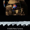 The cord entaglement 