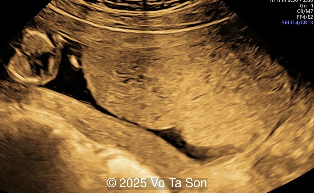 Placenta