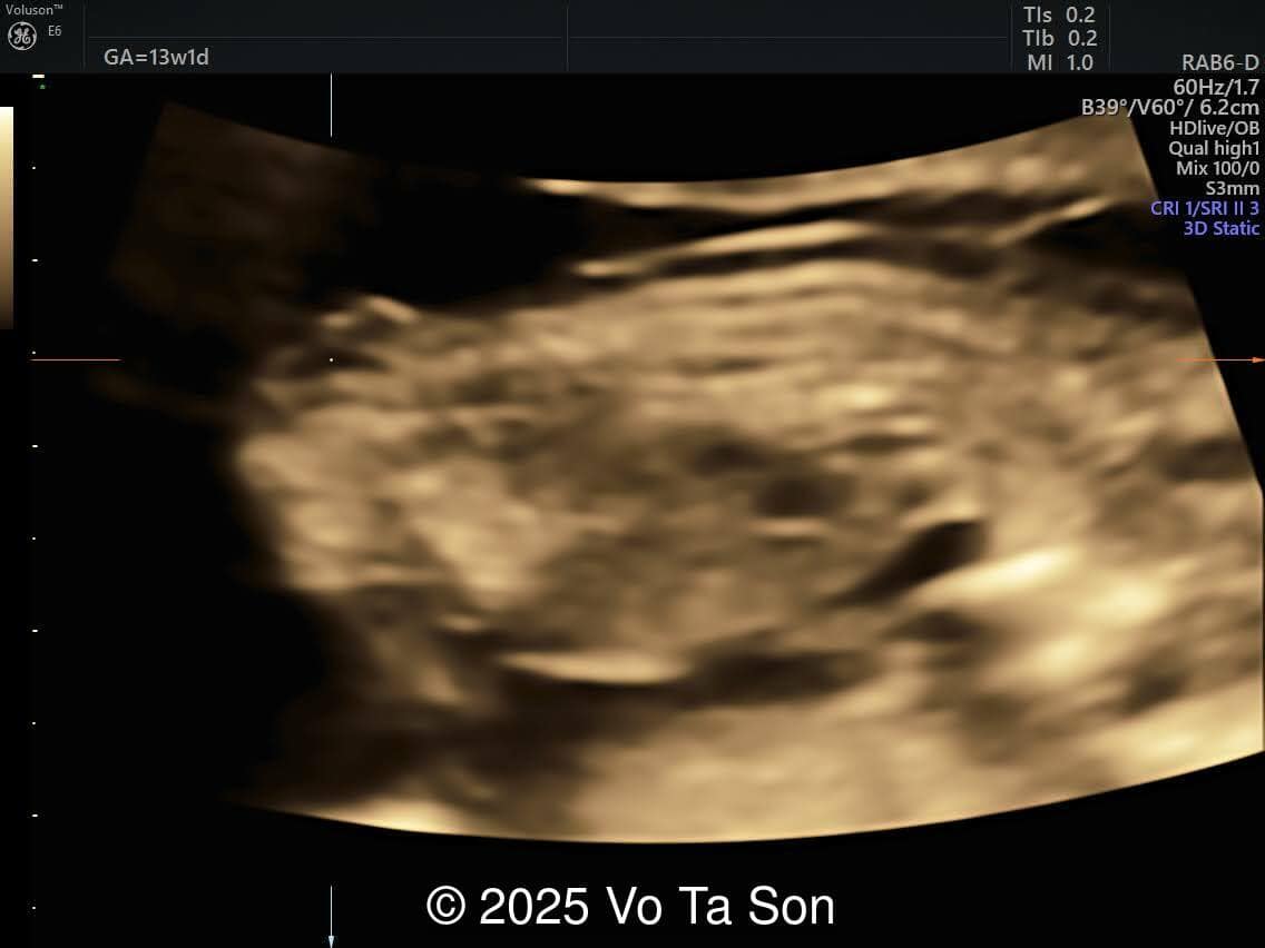 3D Image