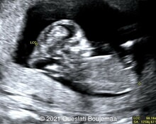 Case of the Week #553 image