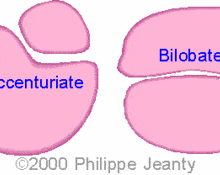 Succenturiate & bilobate placenta image